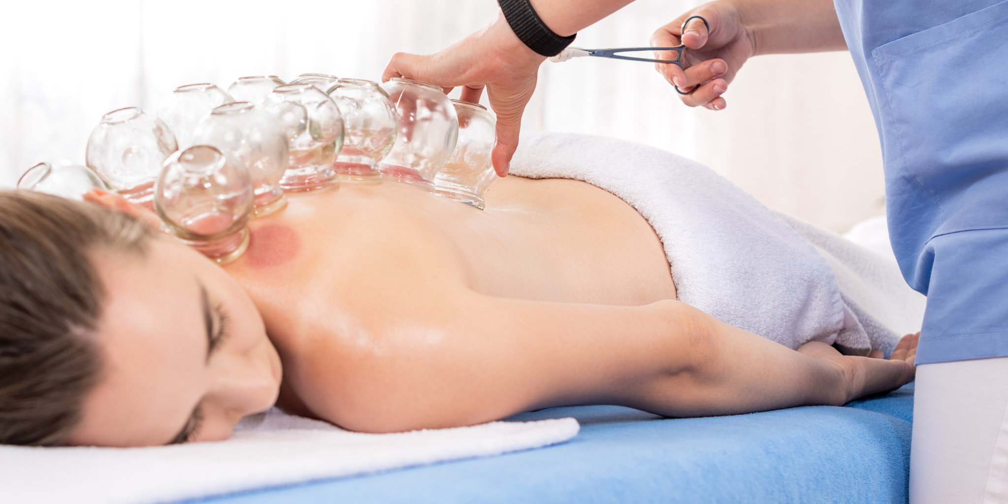 Cupping Therapy in Gurugram