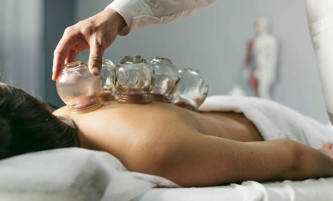 What is cupping therapy?